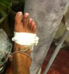 bandaged up horrid feet